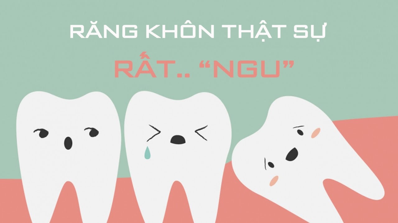 Răng khôn thực tế là rất "ngu"