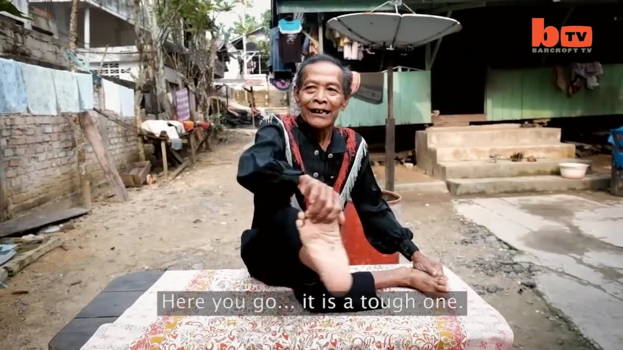 Người đàn ông Indonesia có khả năng quay chân 360 độ