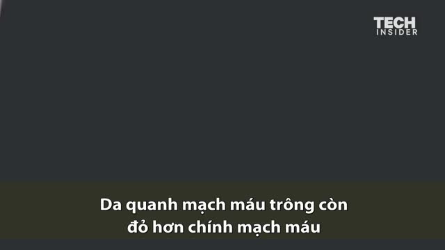 Nguyên nhân tĩnh mạch có màu xanh