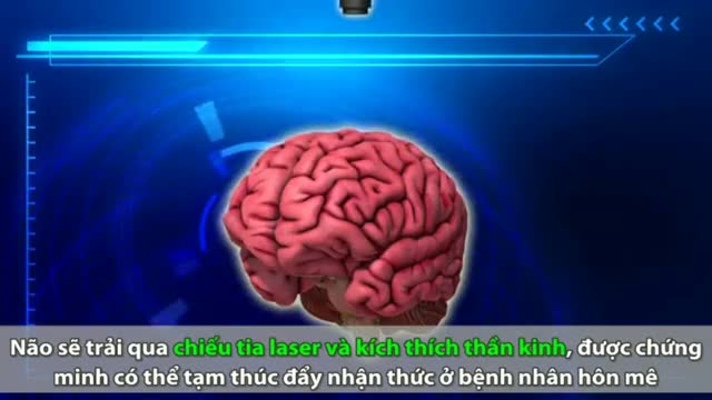 Dự án tái tạo não nhằm hồi sinh người chết 
