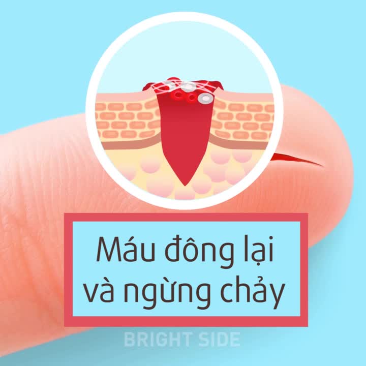 Điều gì xảy ra khi bạn cắt nhầm vào tay?