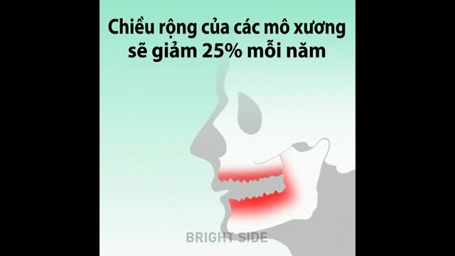 Những biến đổi trên khuôn mặt nếu con người rụng hết răng