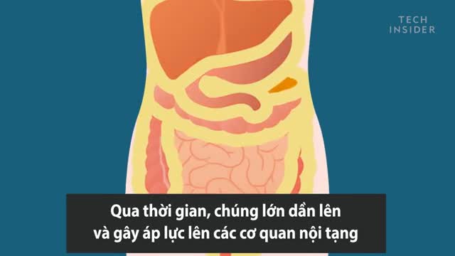 Dự đoán tình trạng sức khỏe dựa trên hình dáng cơ thể