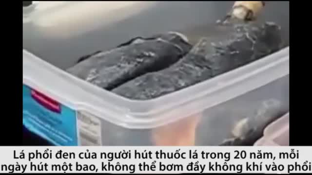 Lá phổi đen kịt của người 20 năm hút thuốc lá