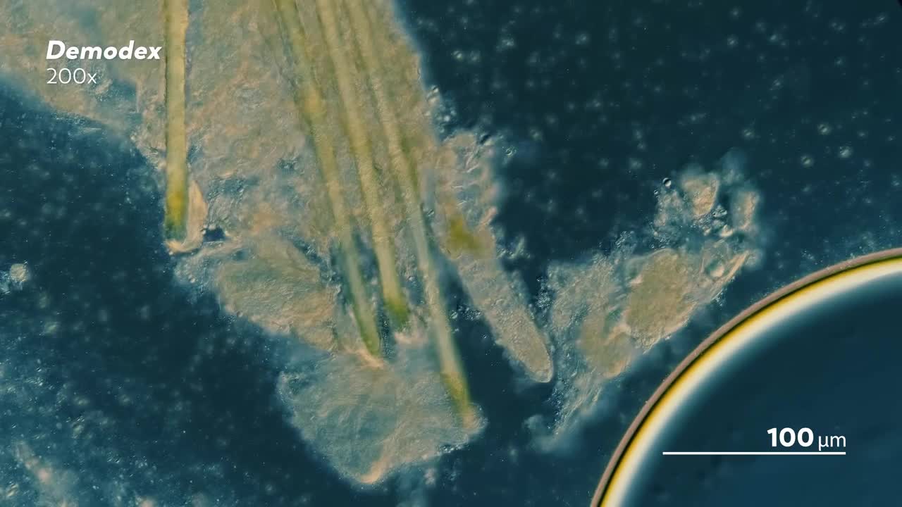 Bọ Demodex lấy từ da người nhìn dưới kính hiển vi