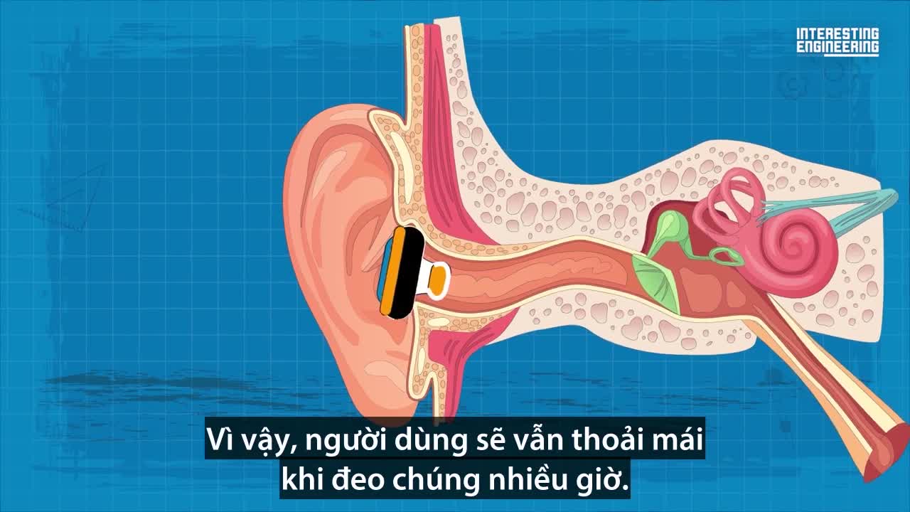 Công nghệ tinh vi phía sau tai nghe khử ồn